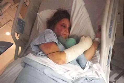 kiira hart|Teenage victim of savage Queensland beating speaks ...